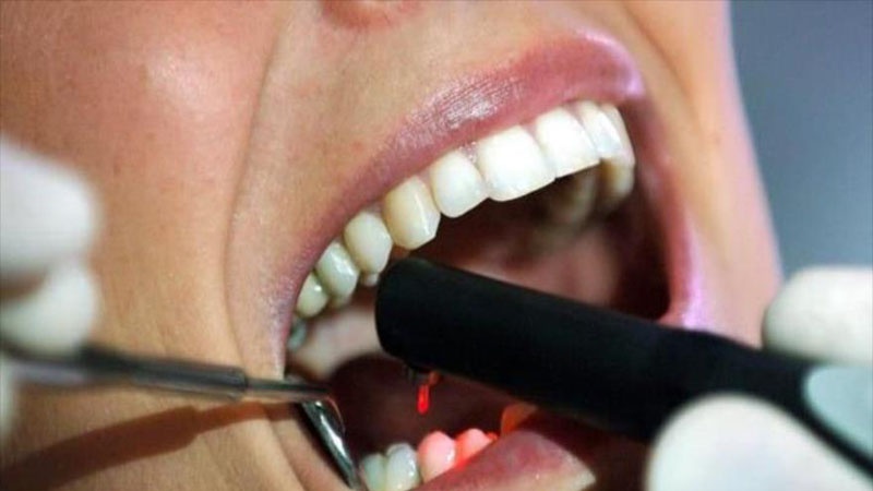چند نکته مهم درمورد دندان درد که از آن بی خبرید