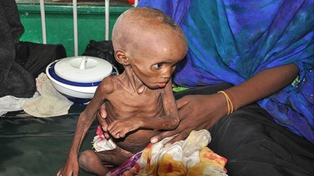 Kananan Yara Kimanin 60,000 Suna Fuskantar Barazanar Mutuwa A Somaliya