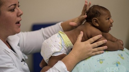 ブラジルで、ジカ熱感染の報告から数百人の小頭症の乳児が誕生
