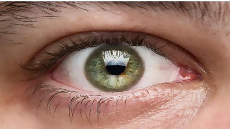 L’aspirine, dangereuse pour la rétine ?