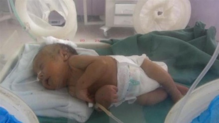 ضربان / امراض مادرزادی قلبی اطفال -2