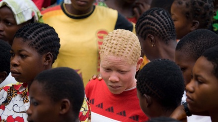 Nchi za Afrika zaanzisha mpango wa kuwalinda Albino