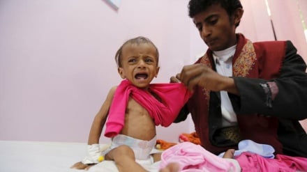Demi Bertahan Hidup, Anak-anak Yaman Makan Daun Anggur
