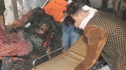 21 milionë jemenas kanë nevojë urgjente për ndihma