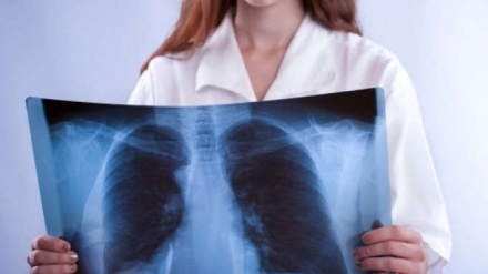 Tumori: nel 2030 moriranno 5,5 milioni di donne nel mondo