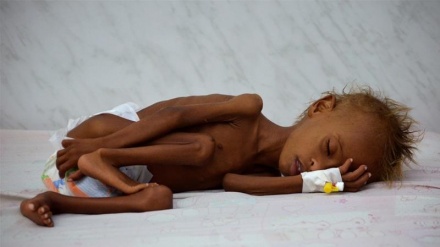 UNICEF: More than 11 million children in Yemen in acute need of aid