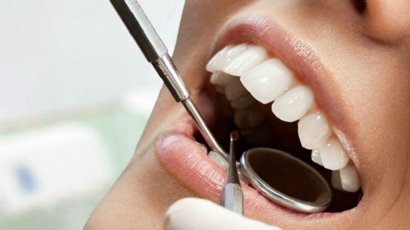  تنقلاتی که دندانپزشکان هرگز توصیه نمی‌ کنند