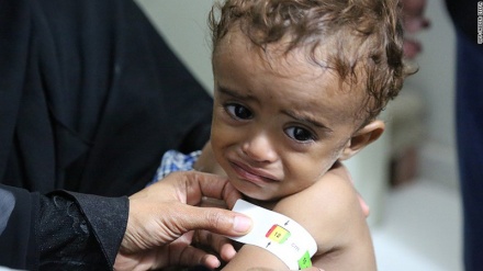 Children starve in Yemen