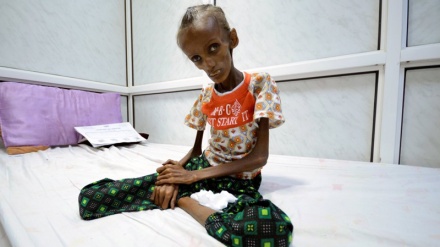 Jemenitische Kinder  - wehrlose Opfer  saudischer Kriegslust