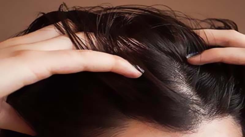 7 facteurs qui rendent vos cheveux gras