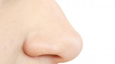 Ҷароҳии  бинӣ ; зебоӣ  ё беморӣ?