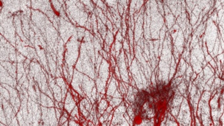 Rigenerato' il cervello grazie al genoma 'spazzatura'