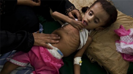 End the ongoing Yemeni catastrophe ‘now’           