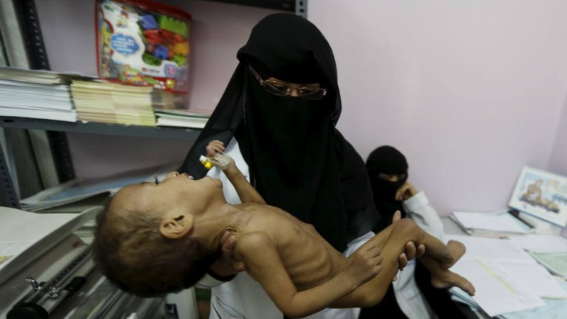 شمار قربانیان وبا در یمن از مرز 1300 نفر گذشت