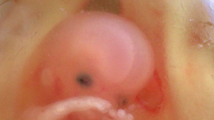 Scoperto lo starter dell'embrione