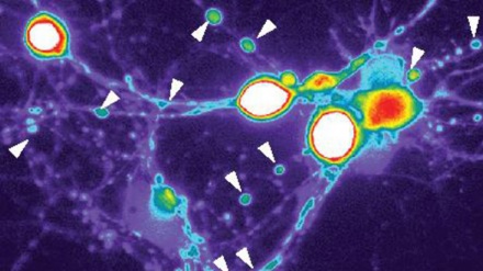 Scoperti due nuovi bersagli per combattere l'Alzheimer