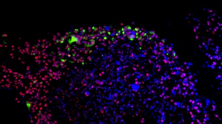 Nuova vita per il virus Zika, diventa un'arma anticancro