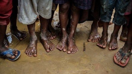 Foto: profughi di Rohingya in Bangladesh- 3
