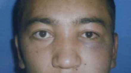 Ўқувчисини калтаклаган ўқитувчи судга тортилди