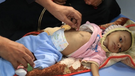 Yemen, 400.000 bambini rischiano morte per malnutrizione acuta