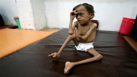 A long time coming: Saudi-made famine in Yemen  