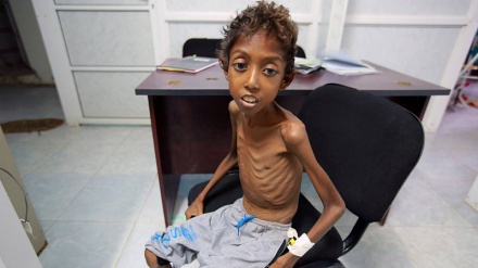 Mjeket Pa Kufi, protestojnë kundër bllokadës së vendosur kundër Jemenit