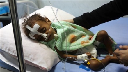 کودکان یمن، قربانی جنگ افروزی آل سعود 