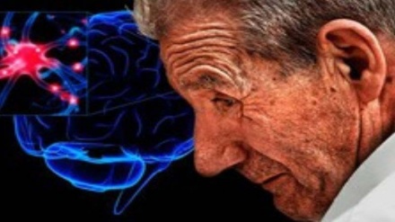  موفقیت محققان ایرانی در تشخیص زود هنگام آلزایمر با نانو حسگرها