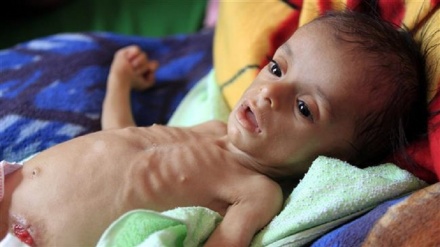 UNICEF: Günde 5 Yemenli çocuk Suudilerin saldırılarında ölmekte