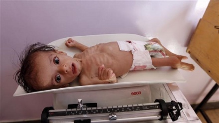 ユニセフが、イエメン人の子ども８００万人の栄養不良について警告