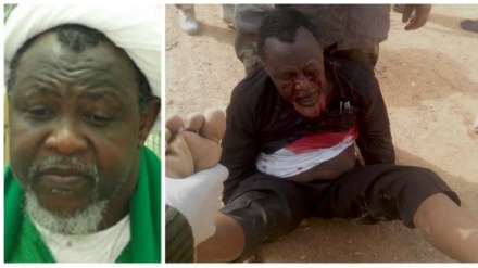 Guterres aombwa kufuatilia hali ya Sheikh Zakzaky ili apatiwe matibabu  