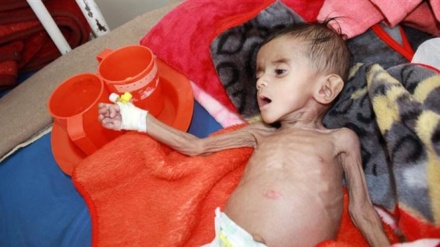 Kızılhaç uyardı: Yemen açlıktan ölmek üzere