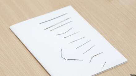 Во ажаб! 11 ойлик болакай баданида 16 дона игна топилди