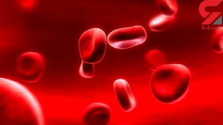 Афзоиши хатари сактаи мағзӣ бо камбуди оҳан 