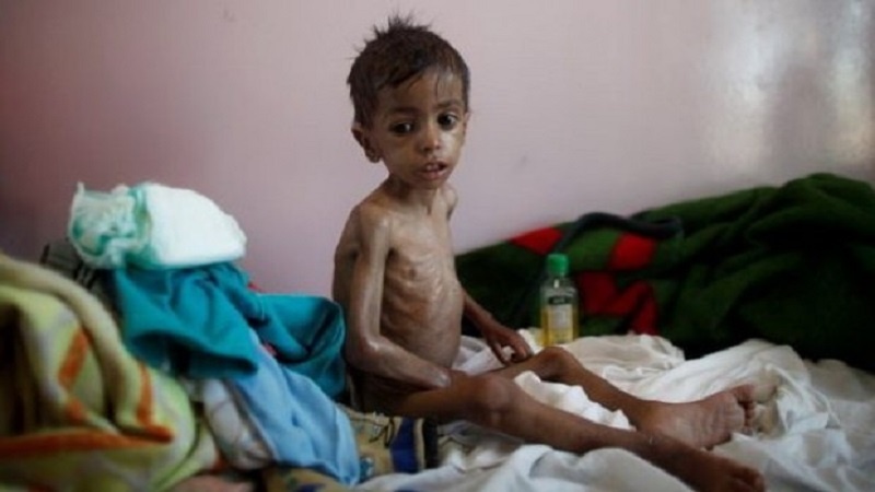  کشته شدن حدود دو هزار یمنی بر اثر کمبود آب و بیماری وبا در 6 ماه گذشته 