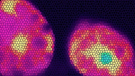 Nel cervello un recettore bruciagrassi