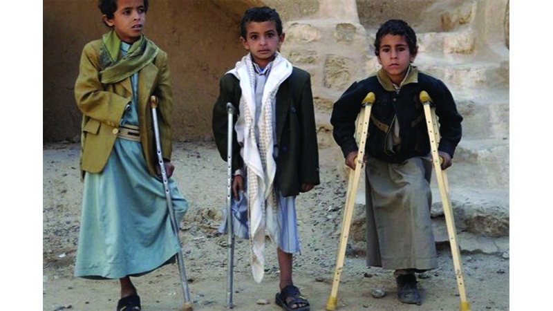 Potret anak-anak Yaman korban serangan koalisi Arab Saudi.