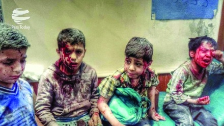 Европа иттифоқи Саудия режимининг яманлик болаларни қирғин қилиш ҳаракатларига муносабат билдирди 