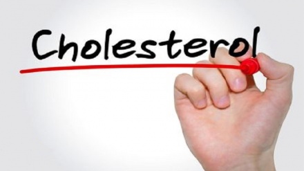 علائم کلسترول خون را بشناسید