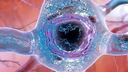 Alzheimer, un esame del sangue lo smaschera in anticipo