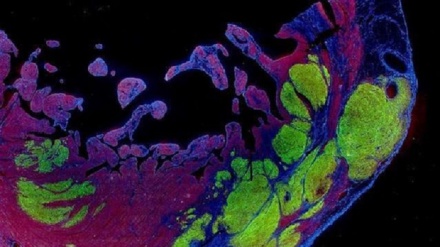 Staminali riparano il cuore dopo l'infarto