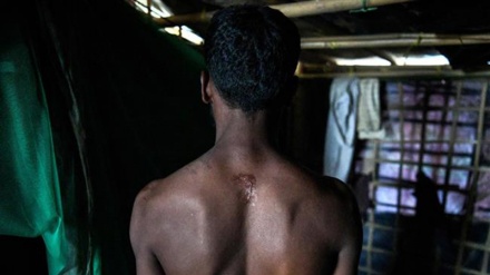 Body of evidence: The scars of the Rohingya Muslims