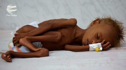 Kurang Dana, WFP Tangguhkan Program Pencegahan Malnutrisi Yaman