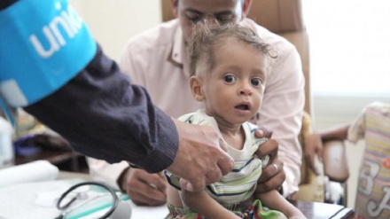 UNICEF : Kananan Yara A Yemen Na Fuskantar Hadarin Yunwa