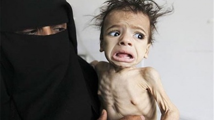 Bebês muito fracos até para chorar': 5,2 milhões de crianças em risco de fome no Iêmen