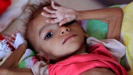 یونیسف : هر 10 دقیقه یک کودک یمنی می میرد