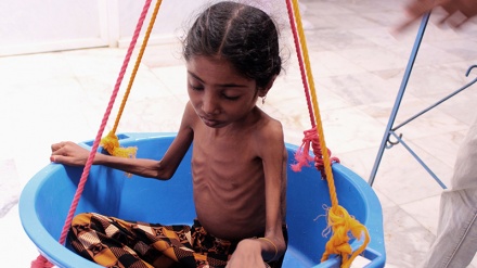 イエメンで、世界最大の人道上の危機が発生