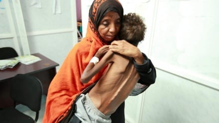 Mbi 18,000 jemenas të vrarë dhe 30 mijë të plagosur në 2,800 ditët e luftës saudite