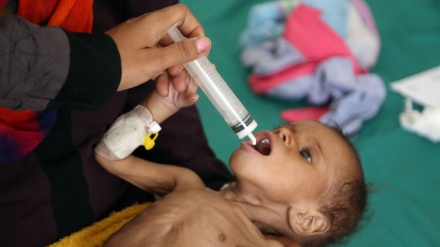 Save the malnourished children in Yemen