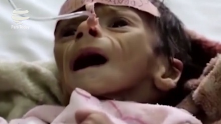 85 000 niños han muerto de hambre en Yemen desde agresión saudí